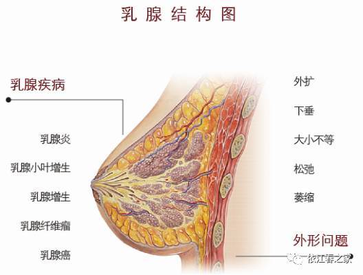 乳腺增生纤维瘤