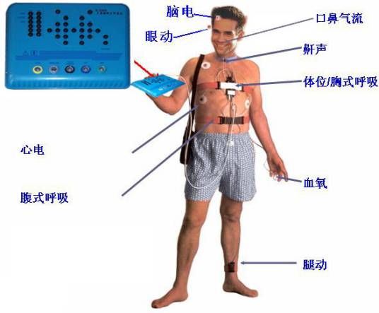 多导睡眠监测系统