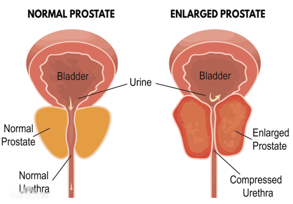 前列腺来自看什么科