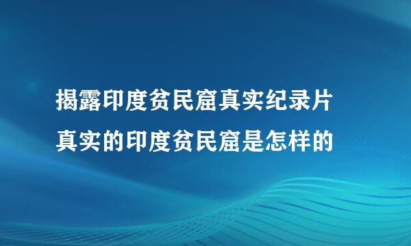 揭露印度贫民窟真实纪录片 真实的印度贫民窟是怎样的