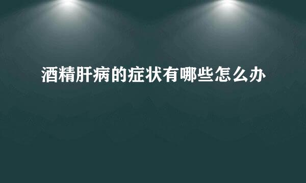 酒精肝病的症状有哪些怎么办