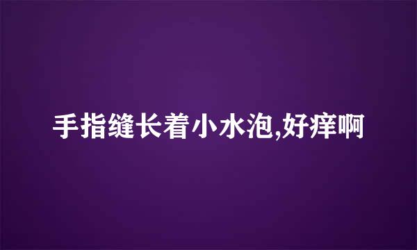 手指缝长着小水泡,好痒啊