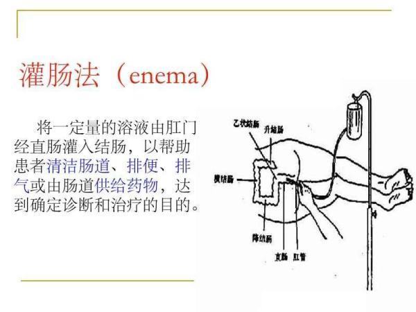 灌肠是啥意思