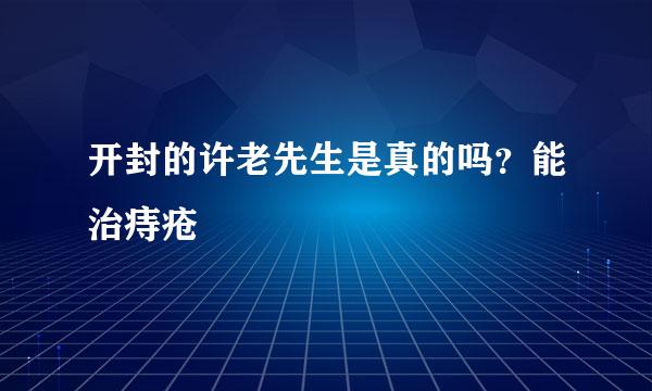 开封的许老先生是真的吗？能治痔疮