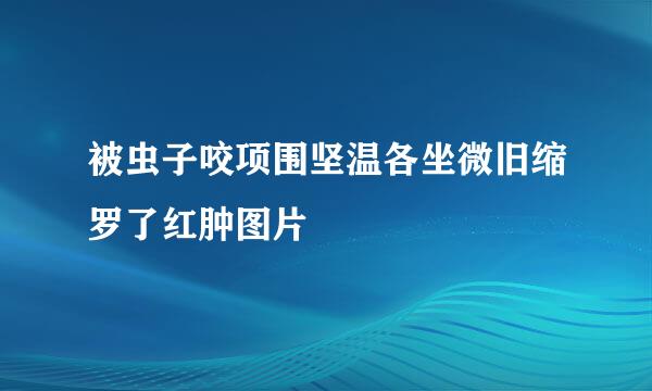 被虫子咬项围坚温各坐微旧缩罗了红肿图片