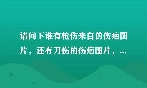 请问下谁有枪伤来自的伤疤图片，还有刀伤的伤疤图片，高清的那种