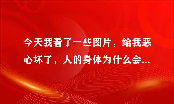 今天我看了一些图片，给我恶心坏了，人的身体为什么会长蛆?甚至脑子里...