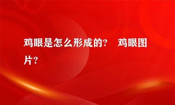 鸡眼是怎么形成的? 鸡眼图片?