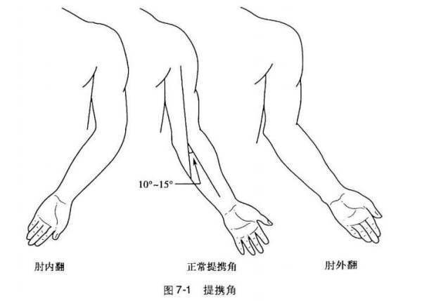 肘外翻导致不能当兵了