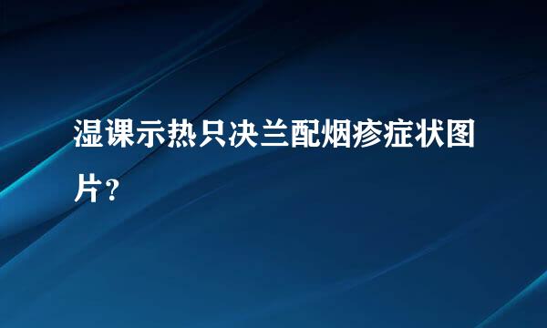 湿课示热只决兰配烟疹症状图片？