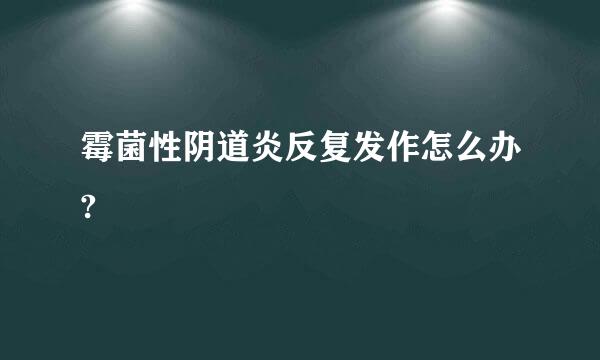 霉菌性阴道炎反复发作怎么办?