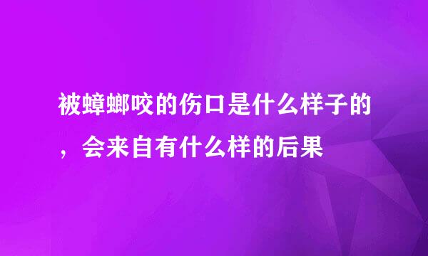 被蟑螂咬的伤口是什么样子的，会来自有什么样的后果