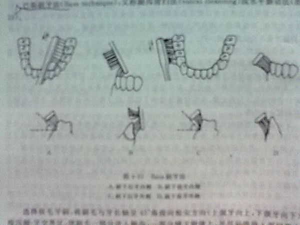 什么是巴氏刷牙法？