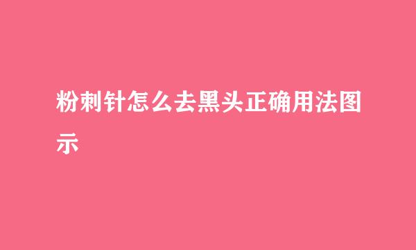 粉刺针怎么去黑头正确用法图示