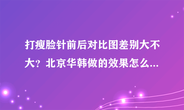 打瘦脸针前后对比图差别大不大？北京华韩做的效果怎么样？很想知道啊？谁来帮忙！