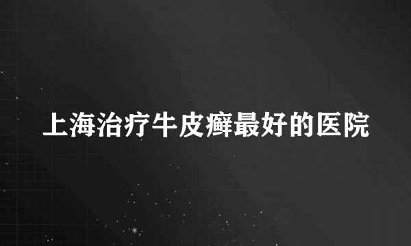 上海治疗牛皮癣最好的医院