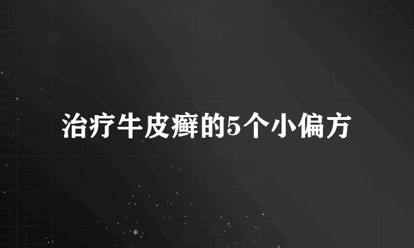 治疗牛皮癣的5个小偏方