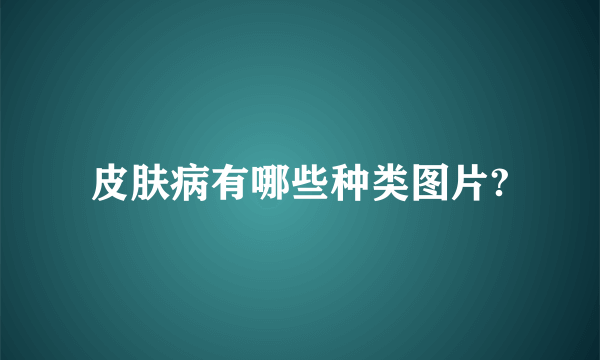 皮肤病有哪些种类图片?