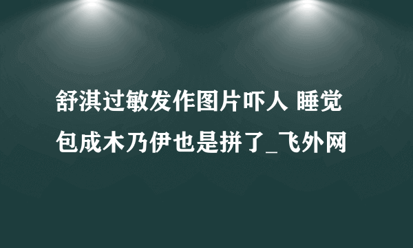 舒淇过敏发作图片吓人 睡觉包成木乃伊也是拼了_飞外网