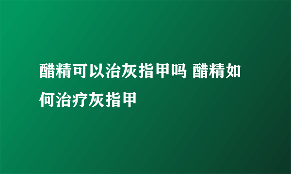 醋精可以治灰指甲吗 醋精如何治疗灰指甲