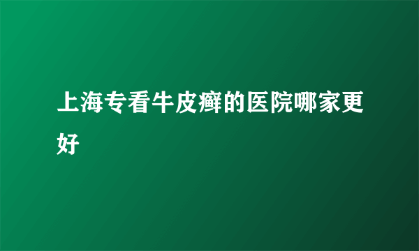 上海专看牛皮癣的医院哪家更好