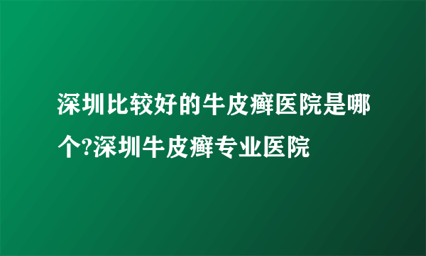 深圳比较好的牛皮癣医院是哪个?深圳牛皮癣专业医院