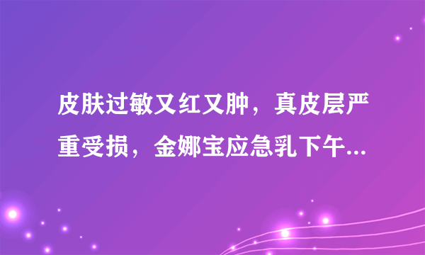 皮肤过敏又红又肿，真皮层严重受损，金娜宝应急乳下午用了晚...