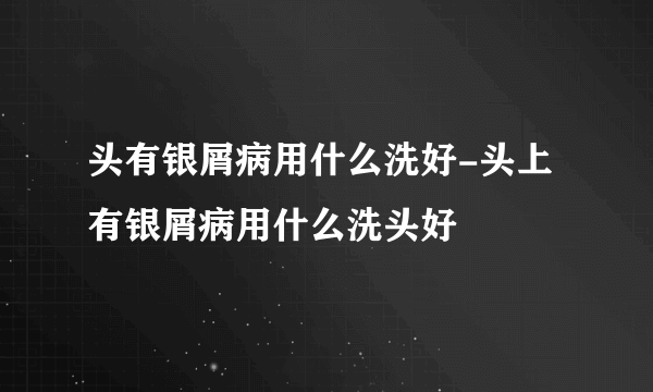 头有银屑病用什么洗好-头上有银屑病用什么洗头好