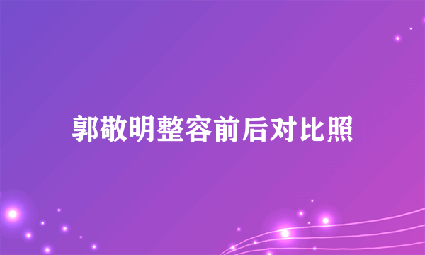 郭敬明整容前后对比照