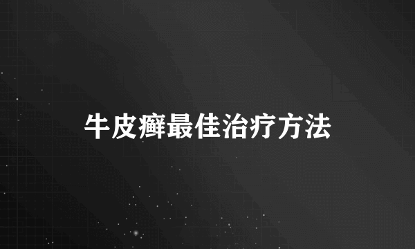 牛皮癣最佳治疗方法