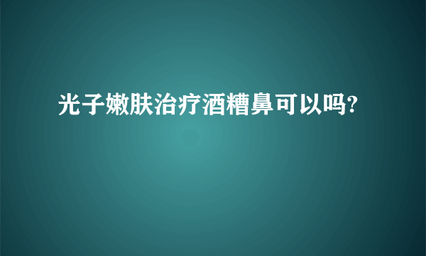 光子嫩肤治疗酒糟鼻可以吗?