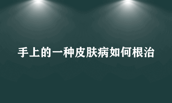 手上的一种皮肤病如何根治