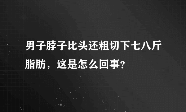 男子脖子比头还粗切下七八斤脂肪，这是怎么回事？