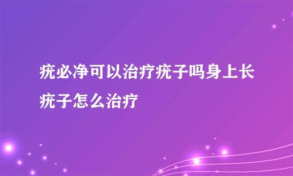 疣必净可以治疗疣子吗身上长疣子怎么治疗