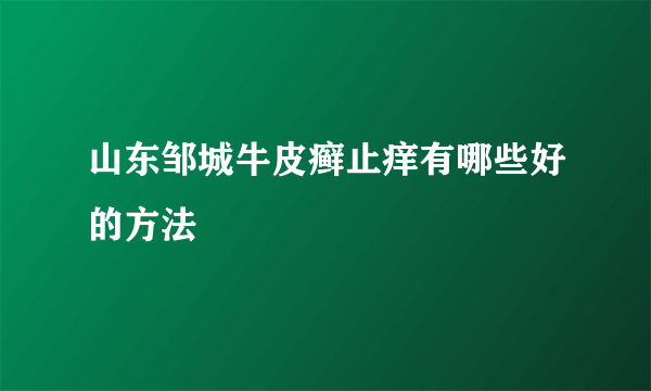 山东邹城牛皮癣止痒有哪些好的方法