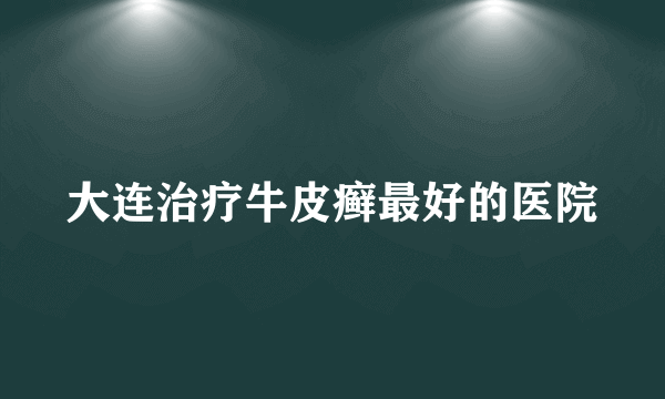 大连治疗牛皮癣最好的医院